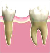インプラント　調査、術前計画